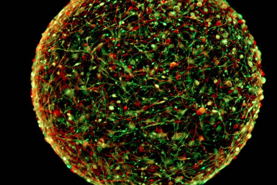 Manmade Artificial Brains That Could Revolutionize Neuroscience