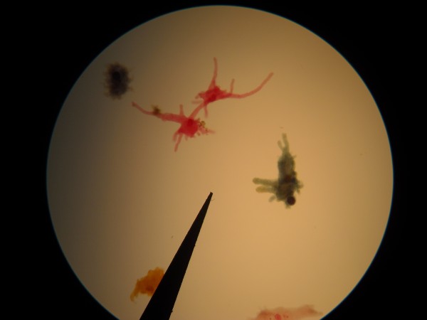 rare brain-eating amoeba 