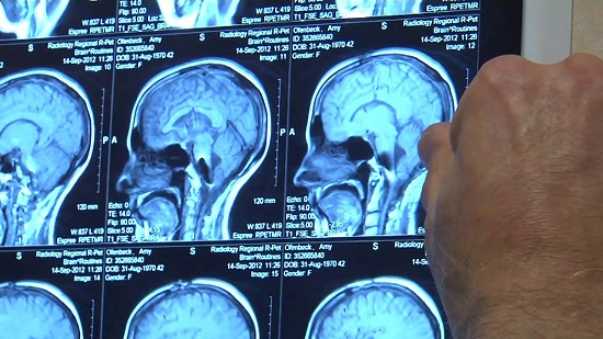 Doctor analyzing brain scan