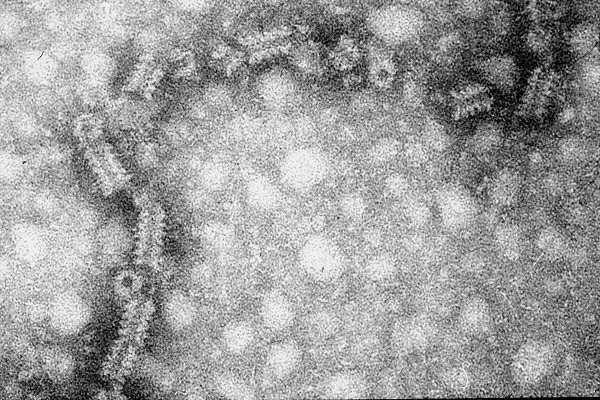 Mumps virus