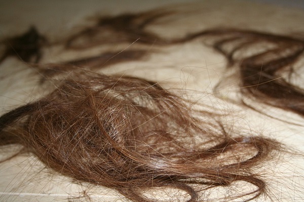 hair loss